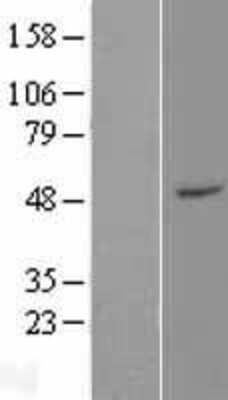 Western Blot: ZFP2 Overexpression Lysate [NBP2-06210]