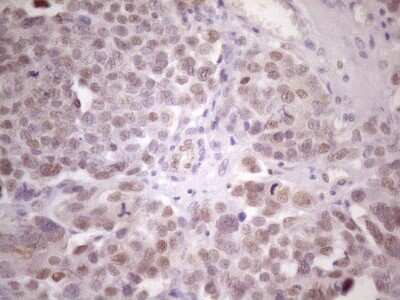 Immunohistochemistry: ZFP200 Antibody (OTI5F4) [NBP2-46423]