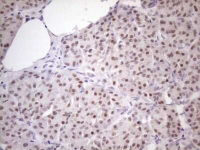 Immunohistochemistry: ZFP200 Antibody (OTI5F4) [NBP2-46423]