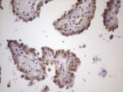Immunohistochemistry: ZFP200 Antibody (OTI5F4) [NBP2-46423]