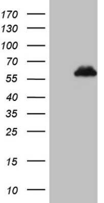 Western Blot: ZFP200 Antibody (OTI5F4) [NBP2-46423]