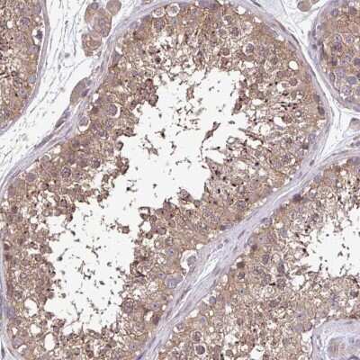 Immunohistochemistry: ZFP200 Antibody [NBP2-38870]