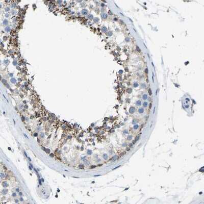 Immunohistochemistry-Paraffin: ZFP200 Antibody [NBP1-87460]