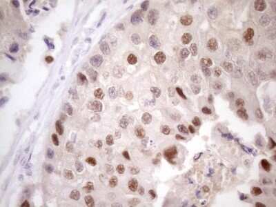 Immunohistochemistry: ZFP200 Antibody (OTI5F4) - Azide and BSA Free [NBP2-74923]