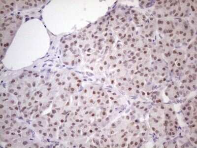 Immunohistochemistry: ZFP200 Antibody (OTI5F4) - Azide and BSA Free [NBP2-74923]