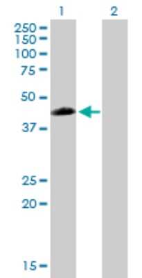 Western Blot: ZFP200 Antibody [H00007752-B01P]