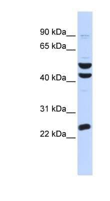 Western Blot: ZFP200 Antibody [NBP1-80301]