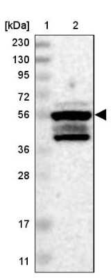 Western Blot: ZFP200 Antibody [NBP1-87460]