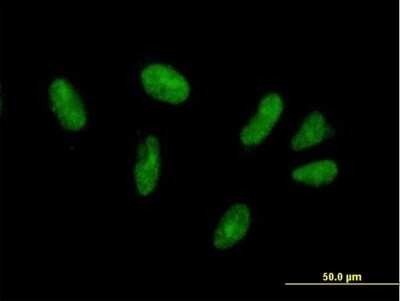 Immunocytochemistry/ Immunofluorescence: ZFP28 Antibody [H00140612-B01P]