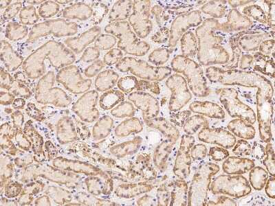 Immunohistochemistry: ZFP28 Antibody [NBP3-06636]