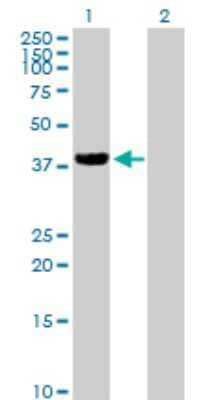 Western Blot: ZFP28 Antibody [H00140612-B01P]