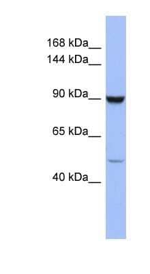 Western Blot: ZFP28 Antibody [NBP1-80348]