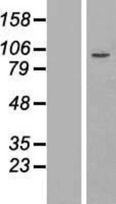 Western Blot: ZFP28 Overexpression Lysate [NBP2-06604]