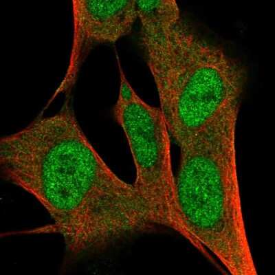 Immunocytochemistry/ Immunofluorescence: ZFP3 Antibody [NBP2-58585]