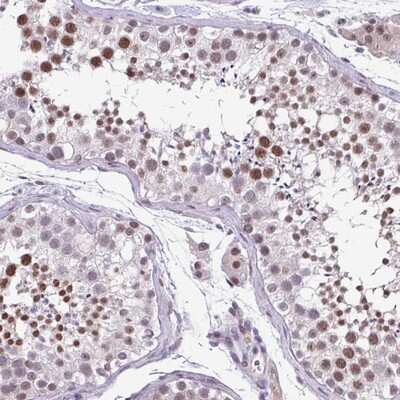 Immunohistochemistry-Paraffin: ZFP3 Antibody [NBP2-13545]