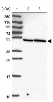 Western Blot: ZFP3 Antibody [NBP2-13545]