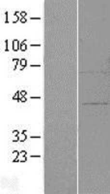 Western Blot: ZFP30 Overexpression Lysate [NBL1-18017]