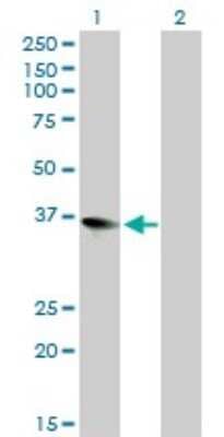 Western Blot: ZFP36L1 Antibody (1A3) [H00000677-M02]