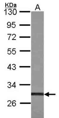 Western Blot: ZFP36L1 Antibody [NBP2-20943]