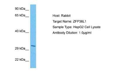 Western Blot: ZFP36L1 Antibody [NBP2-86903]