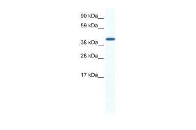 Western Blot: ZFP36L1 Antibody [NBP2-86905]