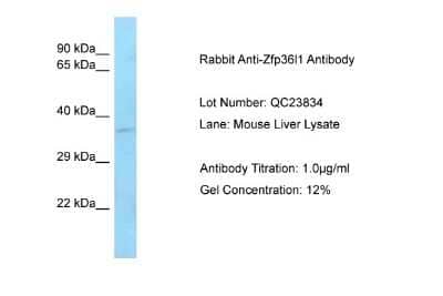 Western Blot: ZFP36L1 Antibody [NBP2-86907]