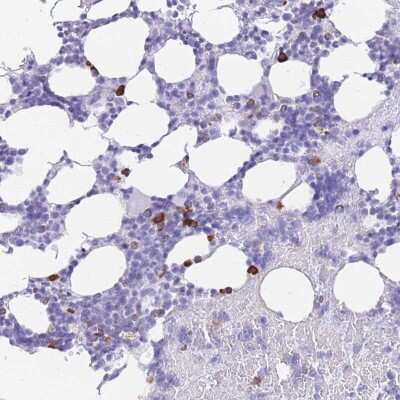 Immunohistochemistry-Paraffin: ZFP37 Antibody [NBP2-13546]