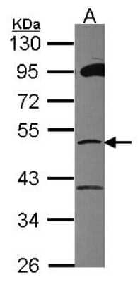 Western Blot: ZSCAN21/ZFP38 Antibody [NBP2-20944]