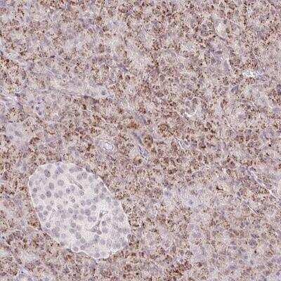 Immunohistochemistry-Paraffin: ZFP41 Antibody [NBP2-31633]