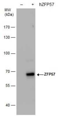 Western Blot: ZFP57 Antibody (1115) [NBP2-43814]