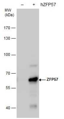 Western Blot: ZFP57 Antibody (4512) [NBP2-43812]