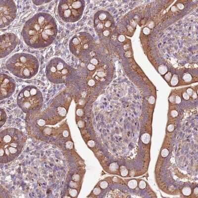 Immunohistochemistry-Paraffin: ZFP57 Antibody [NBP1-94138]