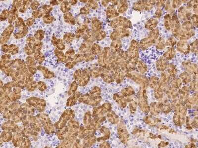 Immunohistochemistry-Paraffin: ZFP57 Antibody [NBP2-99543]