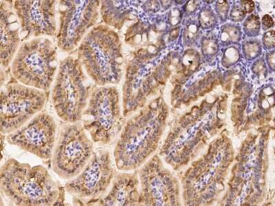 Immunohistochemistry-Paraffin: ZFP57 Antibody [NBP2-99543]