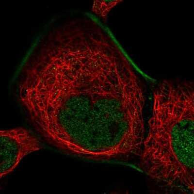 Immunocytochemistry/ Immunofluorescence: ZFP62 Antibody [NBP2-13547]