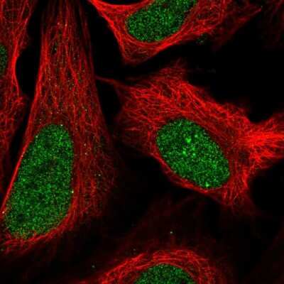 Immunocytochemistry/ Immunofluorescence: ZFP64 Antibody [NBP2-38852]