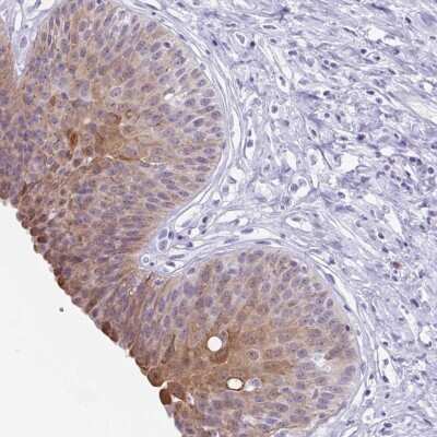 Immunohistochemistry: ZFP64 Antibody [NBP2-38852]