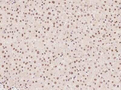 Immunohistochemistry-Paraffin: ZFP64 Antibody [NBP2-97565]