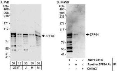 Western Blot: ZFP64 Antibody [NBP1-78187]