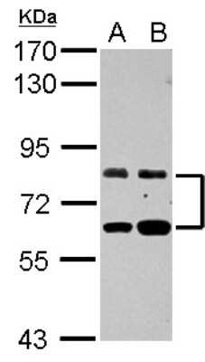 Western Blot: ZFP64 Antibody [NBP2-20945]