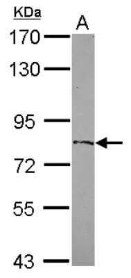 Western Blot: ZFP64 Antibody [NBP2-20946]