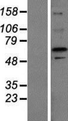 Western Blot: ZFP64 Overexpression Lysate [NBP2-04613]