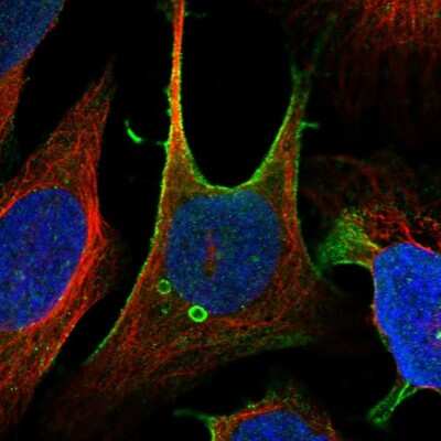 Immunocytochemistry/ Immunofluorescence: ZFP90 Antibody [NBP1-81355]