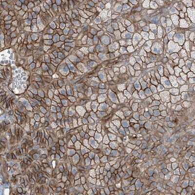 Immunohistochemistry-Paraffin: ZFP90 Antibody [NBP1-81355]