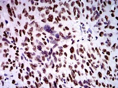 Immunohistochemistry: ZFP91 Antibody (7G11H2) - BSA Free [NBP2-61854]