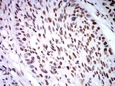 Immunohistochemistry: ZFP91 Antibody (7G11H2) - BSA Free [NBP2-61854]