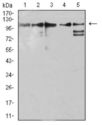 Western Blot: ZFP91 Antibody (7G11H2)BSA Free [NBP2-61854]