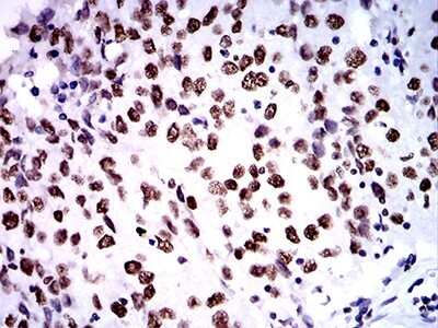 Immunohistochemistry: ZFP91 Antibody (8C3D5) - BSA Free [NBP2-61847]