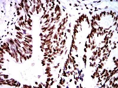 Immunohistochemistry: ZFP91 Antibody (8C3D5) - BSA Free [NBP2-61847]