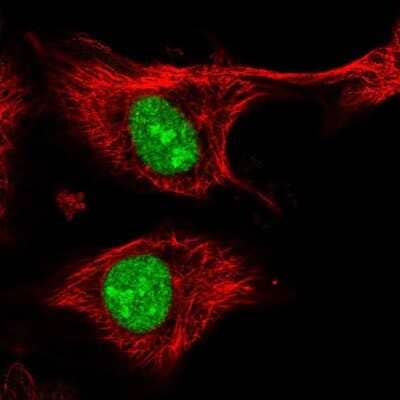 Immunocytochemistry/ Immunofluorescence: ZFP91 Antibody [NBP2-55792]